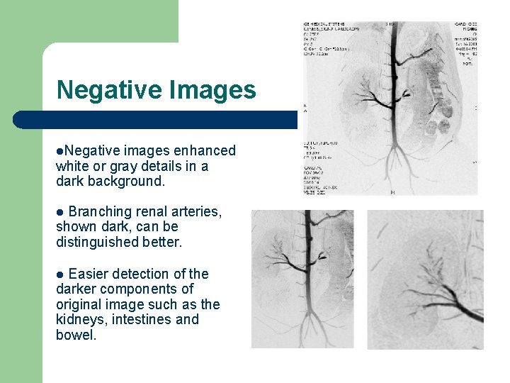 Negative Images l. Negative images enhanced white or gray details in a dark background.
