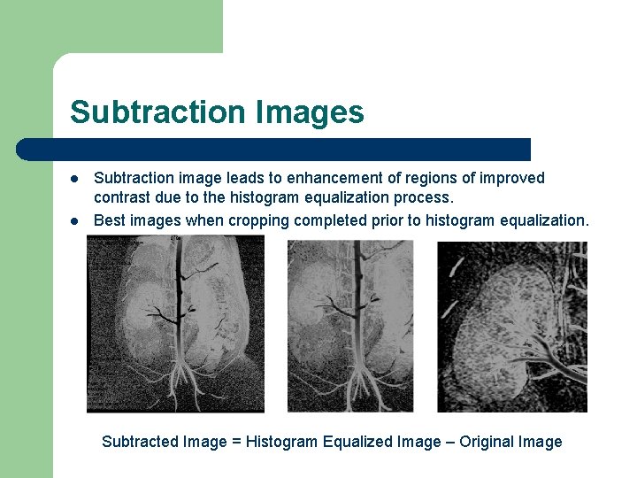 Subtraction Images l l Subtraction image leads to enhancement of regions of improved contrast