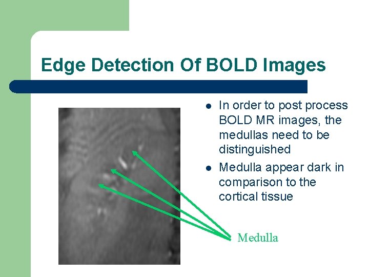 Edge Detection Of BOLD Images l l In order to post process BOLD MR