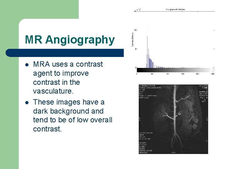 MR Angiography l l MRA uses a contrast agent to improve contrast in the