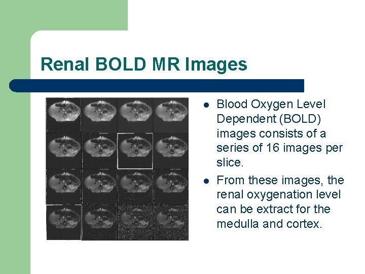 Renal BOLD MR Images l l Blood Oxygen Level Dependent (BOLD) images consists of