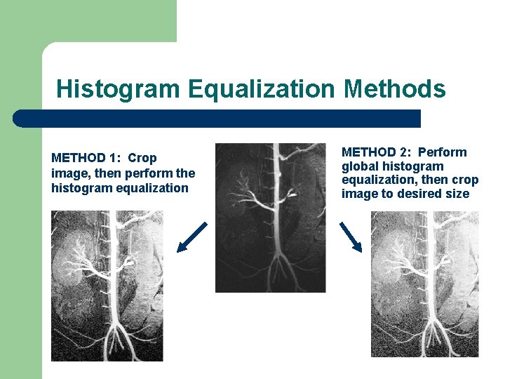 Histogram Equalization Methods METHOD 1: Crop image, then perform the histogram equalization METHOD 2: