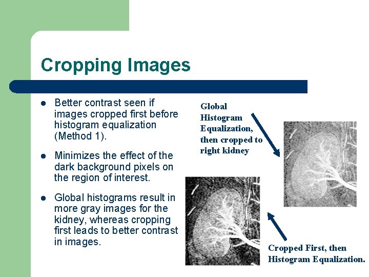 Cropping Images l Better contrast seen if images cropped first before histogram equalization (Method
