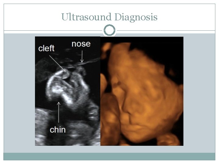 Ultrasound Diagnosis 