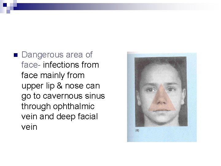 n Dangerous area of face- infections from face mainly from upper lip & nose