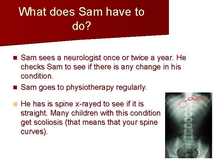 What does Sam have to do? Sam sees a neurologist once or twice a