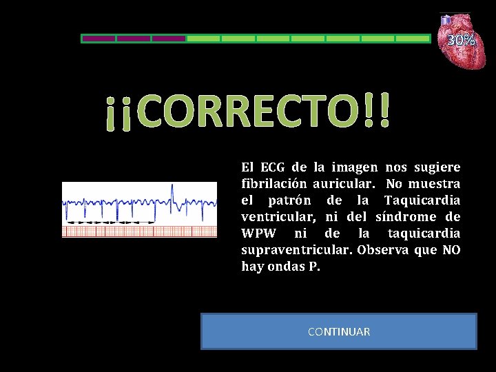 30% ¡¡CORRECTO!! El ECG de la imagen nos sugiere fibrilación auricular. No muestra el