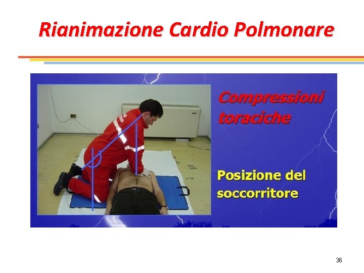 Rianimazione Cardio Polmonare 36 