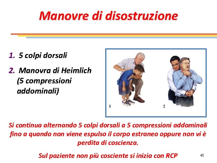 Manovre di disostruzione 1. 5 colpi dorsali 2. Manovra di Heimlich (5 compressioni addominali)