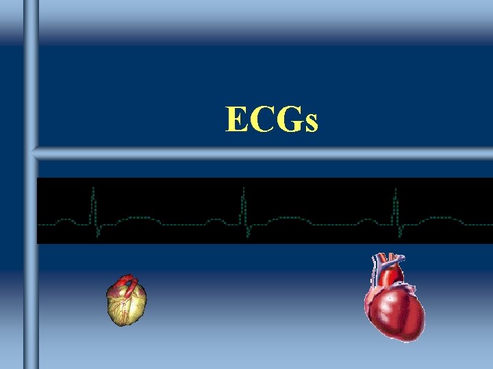 ECGs 