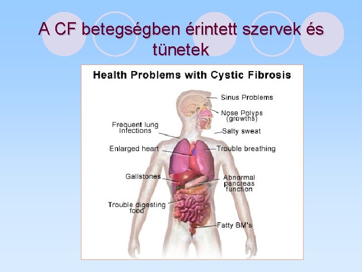 A CF betegségben érintett szervek és tünetek 