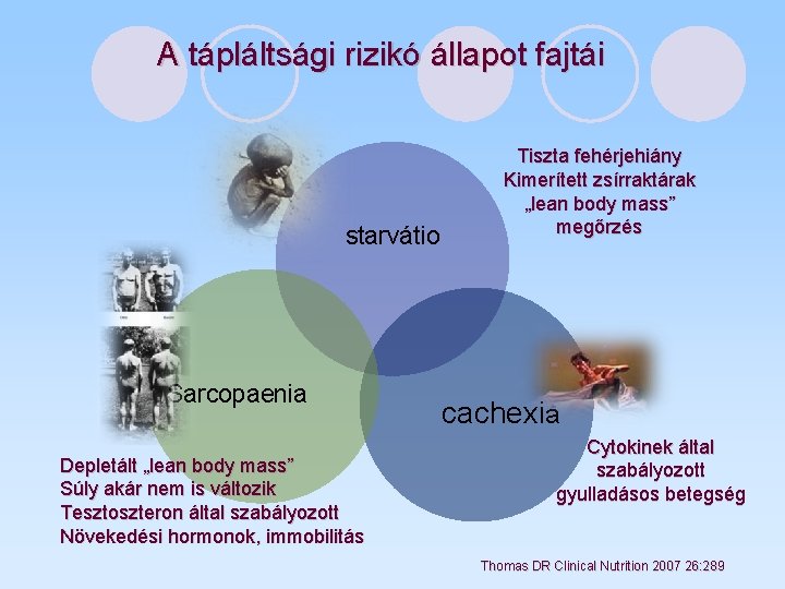 A tápláltsági rizikó állapot fajtái starvátio Sarcopaenia Depletált „lean body mass” Súly akár nem