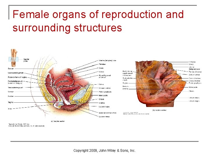 Female organs of reproduction and surrounding structures Copyright 2009, John Wiley & Sons, Inc. Female organs of reproduction and surrounding structures Copyright 2009, John Wiley & Sons, Inc.