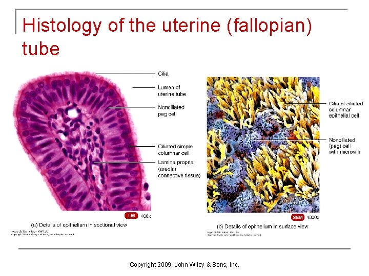 Histology of the uterine (fallopian) tube Copyright 2009, John Wiley & Sons, Inc. Histology of the uterine (fallopian) tube Copyright 2009, John Wiley & Sons, Inc.