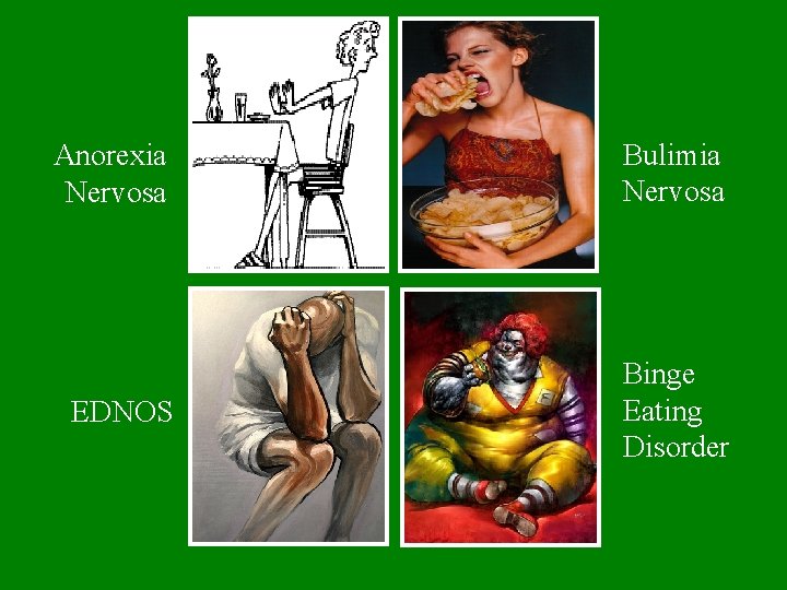 Anorexia Nervosa Bulimia Nervosa EDNOS Binge Eating Disorder 