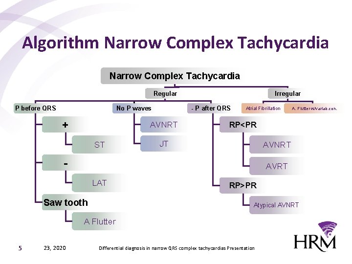 Algorithm Narrow Complex Tachycardia Regular - P after QRS No P waves P before