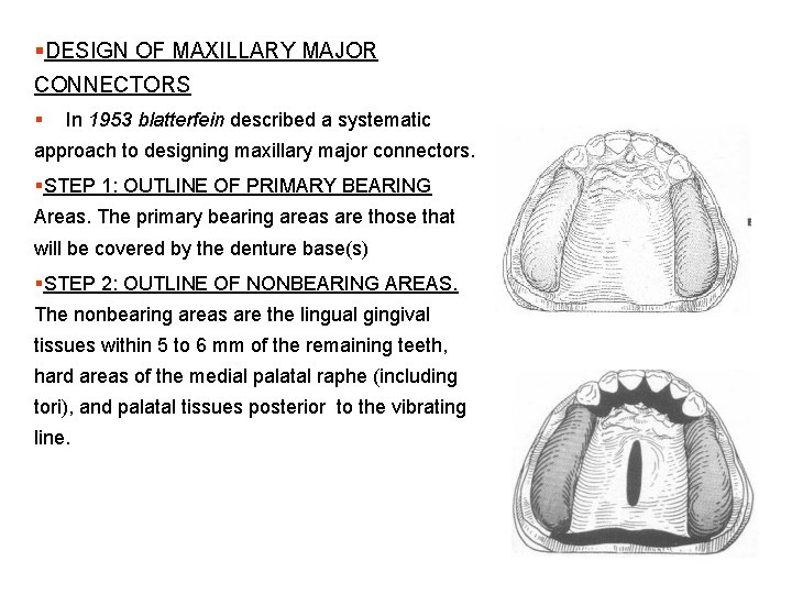 §DESIGN OF MAXILLARY MAJOR CONNECTORS § In 1953 blatterfein described a systematic approach to