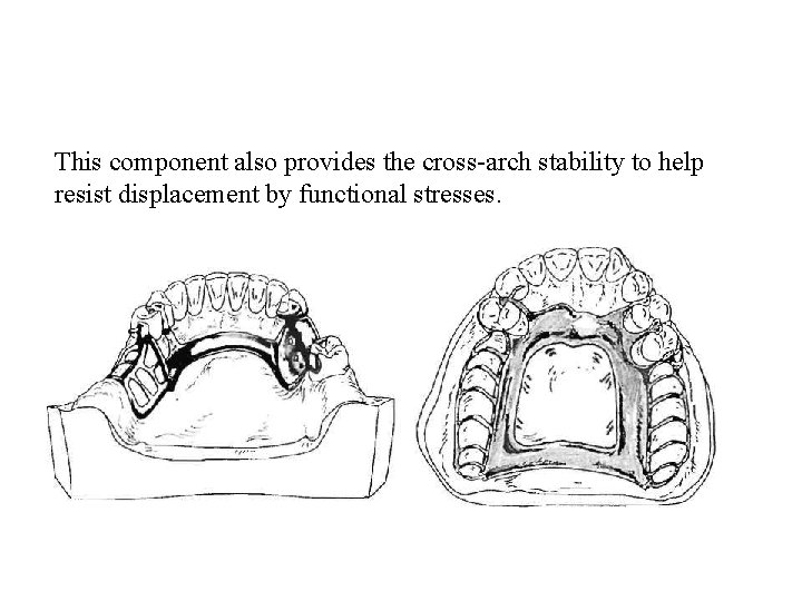 This component also provides the cross-arch stability to help resist displacement by functional stresses.