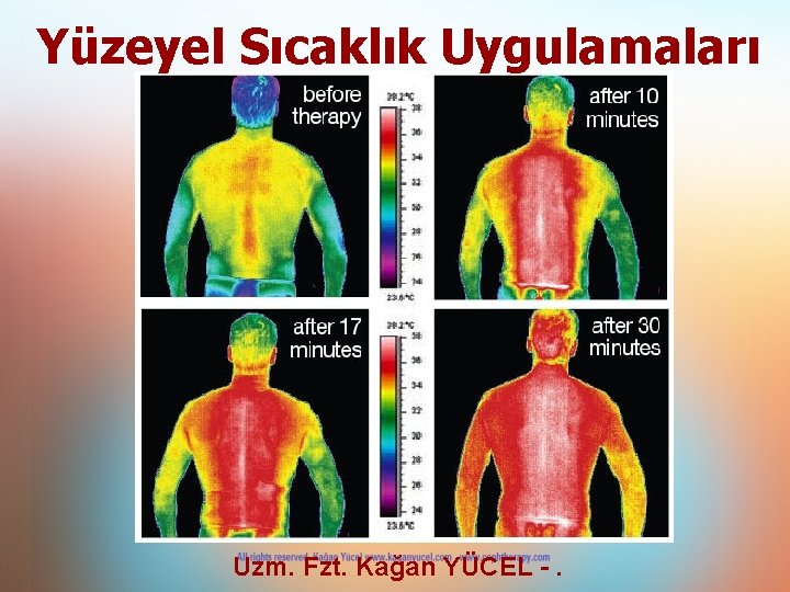 Yüzeyel Sıcaklık Uygulamaları Uzm. Fzt. Kağan YÜCEL -. Yüzeyel Sıcaklık Uygulamaları Uzm. Fzt. Kağan YÜCEL -.