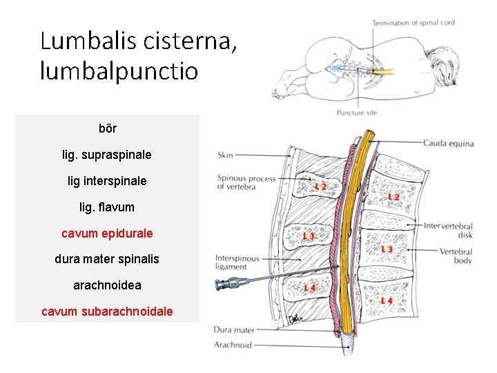 Lumbalis cisterna, lumbalpunctio bőr lig. supraspinale lig interspinale lig. flavum cavum epidurale dura mater