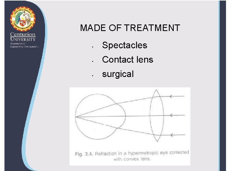 MADE OF TREATMENT • Spectacles • Contact lens • surgical 