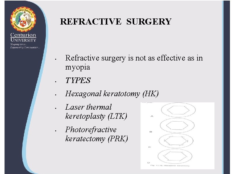 REFRACTIVE SURGERY • Refractive surgery is not as effective as in myopia • TYPES