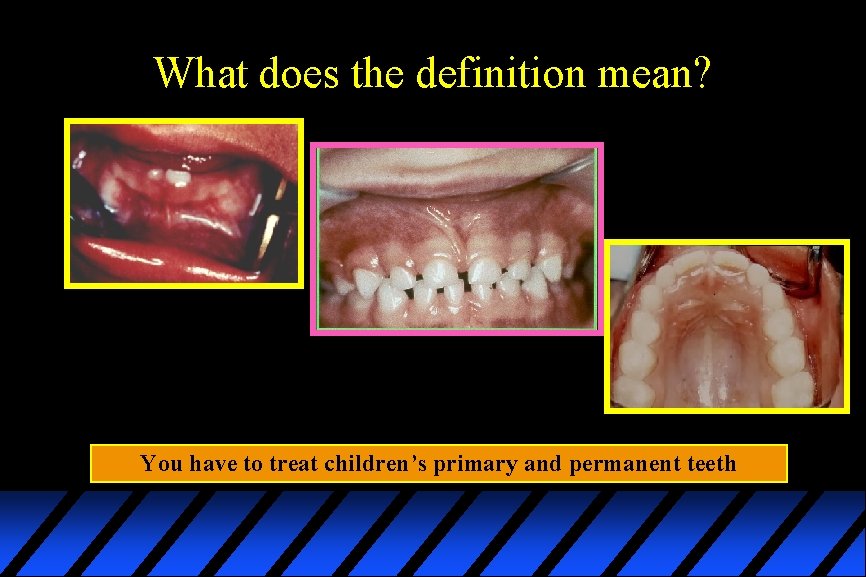 What does the definition mean? You have to treat children’s primary and permanent teeth