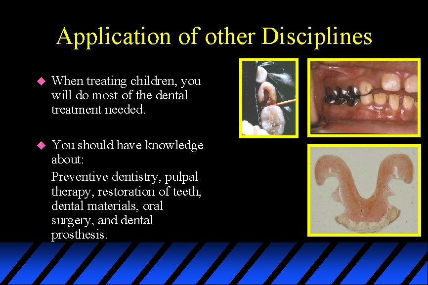 Application of other Disciplines u When treating children, you will do most of the