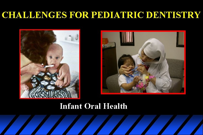CHALLENGES FOR PEDIATRIC DENTISTRY Infant Oral Health 