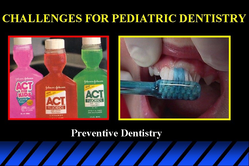CHALLENGES FOR PEDIATRIC DENTISTRY Preventive Dentistry 
