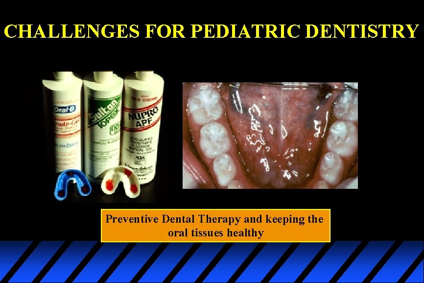 CHALLENGES FOR PEDIATRIC DENTISTRY Preventive Dental Therapy and keeping the oral tissues healthy 