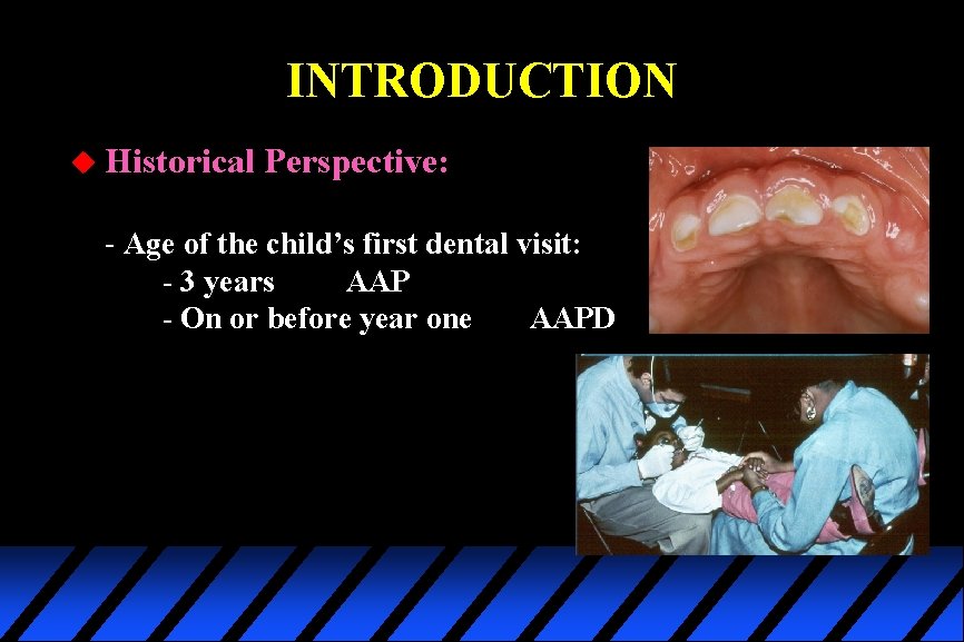 INTRODUCTION u Historical Perspective: - Age of the child’s first dental visit: - 3