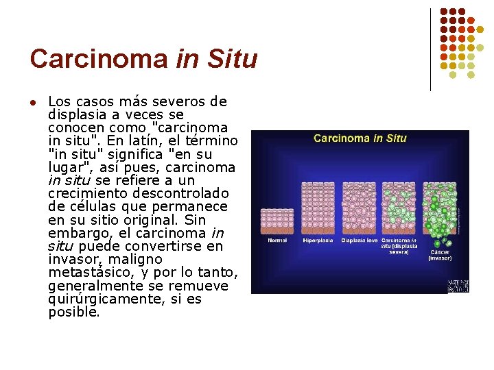 Carcinoma in Situ l Los casos más severos de displasia a veces se conocen