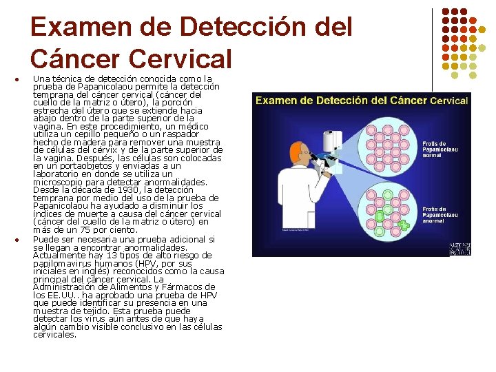 Examen de Detección del Cáncer Cervical l l Una técnica de detección conocida como