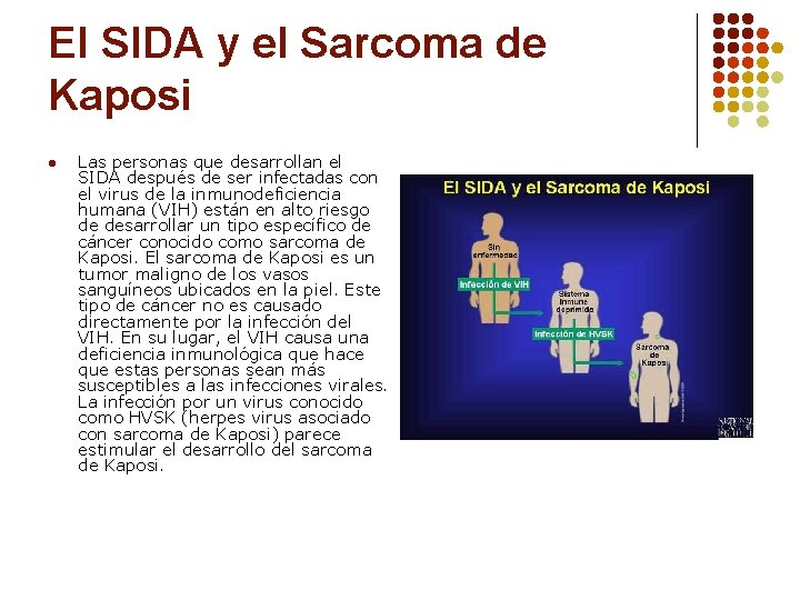 El SIDA y el Sarcoma de Kaposi l Las personas que desarrollan el SIDA