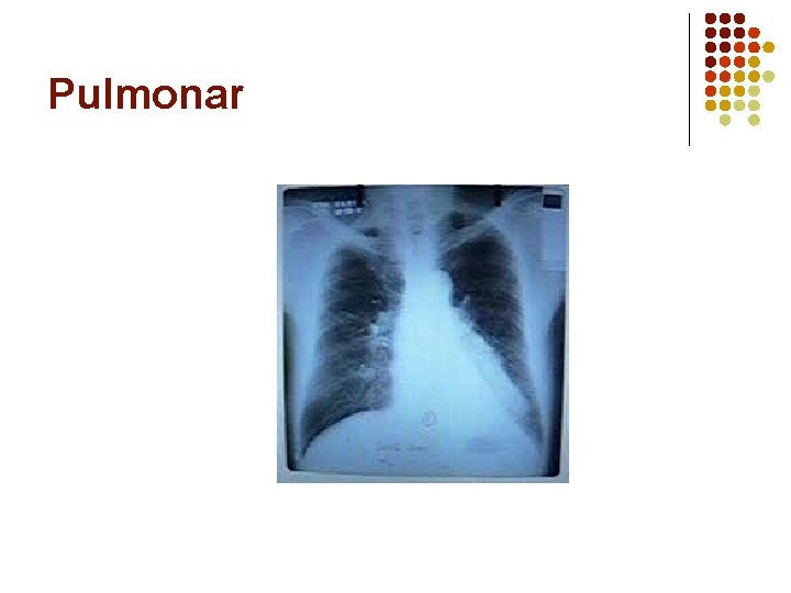 Pulmonar 