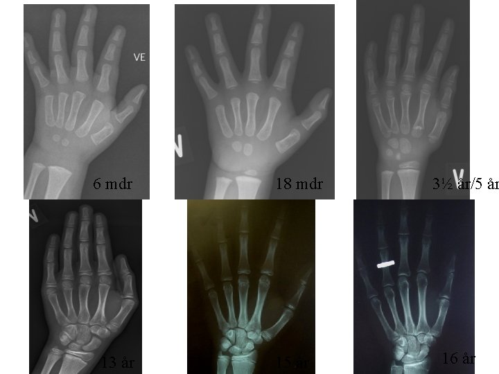 6 mdr 13 år 18 mdr 15 år 3½ år/5 år 16 år 