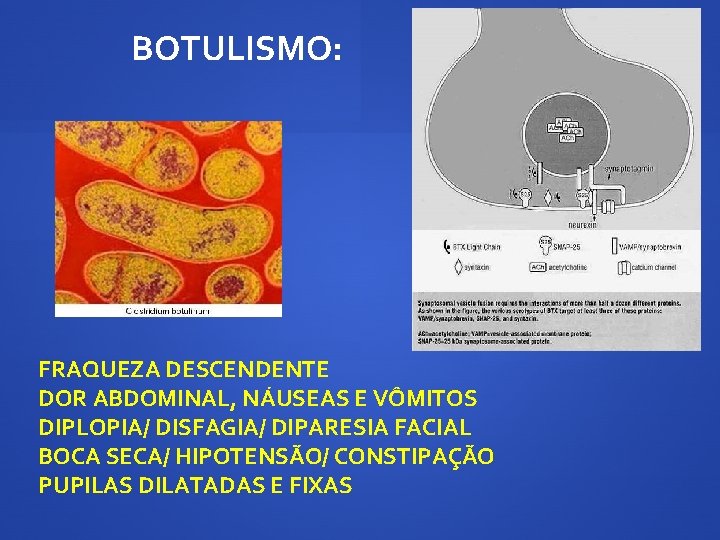 BOTULISMO: FRAQUEZA DESCENDENTE DOR ABDOMINAL, NÁUSEAS E VÔMITOS DIPLOPIA/ DISFAGIA/ DIPARESIA FACIAL BOCA SECA/