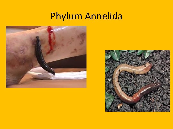 annelids pinworm)