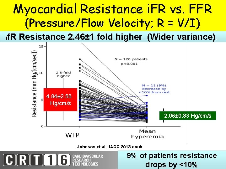 Myocardial Resistance i. FR vs. FFR Myocardial Resistance (Pressure/Flow Velocity; R R == V/I)