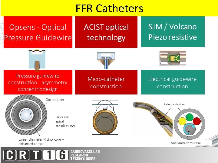 FFR Catheters 