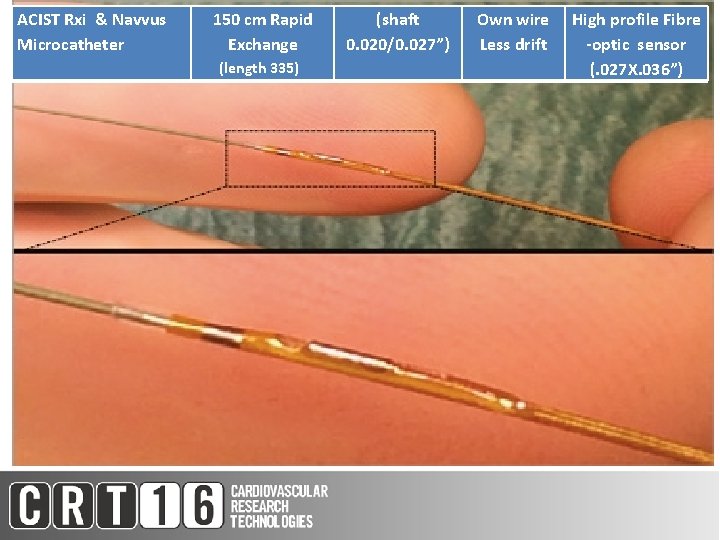 ACIST Rxi & Navvus Microcatheter 150 cm Rapid Exchange (shaft 0. 020/0. 027”) Own