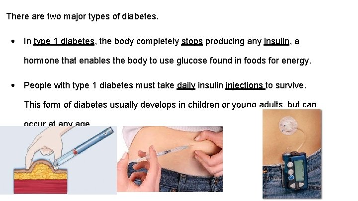 There are two major types of diabetes. • In type 1 diabetes, the body