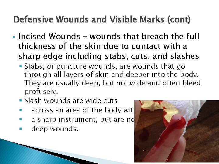 Defensive Wounds and Visible Marks (cont) § Incised Wounds – wounds that breach the