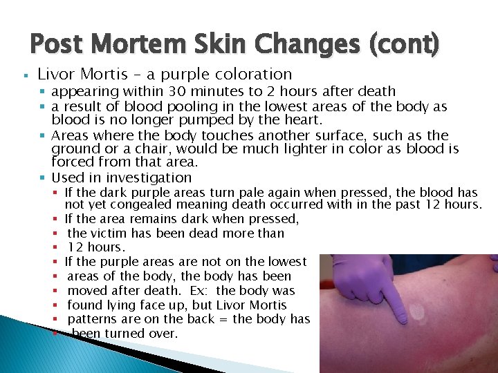 Post Mortem Skin Changes (cont) § Livor Mortis – a purple coloration § appearing
