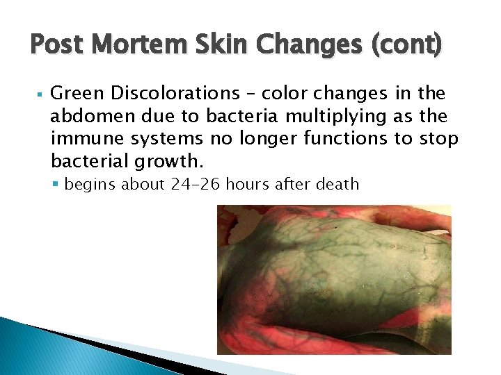 Post Mortem Skin Changes (cont) § Green Discolorations – color changes in the abdomen