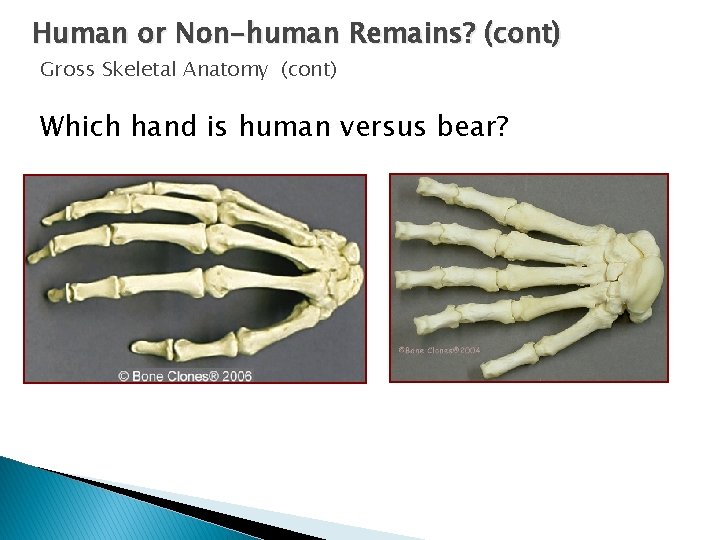 Human or Non-human Remains? (cont) Gross Skeletal Anatomy (cont) Which hand is human versus