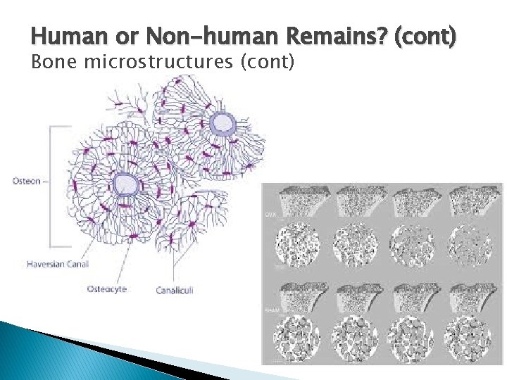 Human or Non-human Remains? (cont) Bone microstructures (cont) 