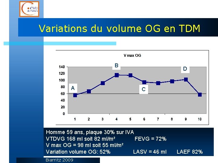 Variations du volume OG en TDM B A D C Homme 59 ans, plaque