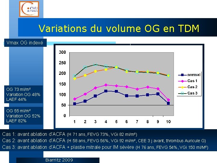 Variations du volume OG en TDM Vmax OG indexé OG 73 ml/m² Variation OG